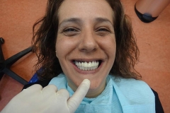 Implantaciya+metallokeramika-04